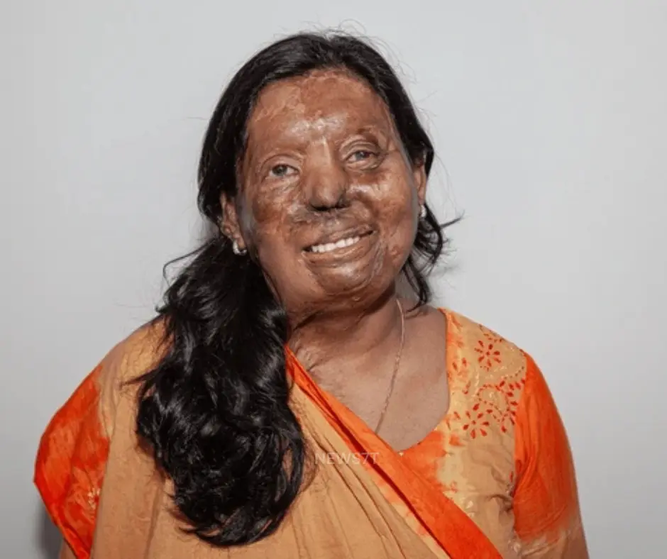 Acid Attack