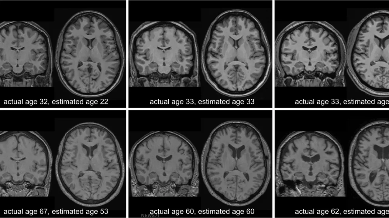 Mental Illness and Brain Aging 2026: Surprising Facts About Mental Health and Brain Aging (photo 4)
