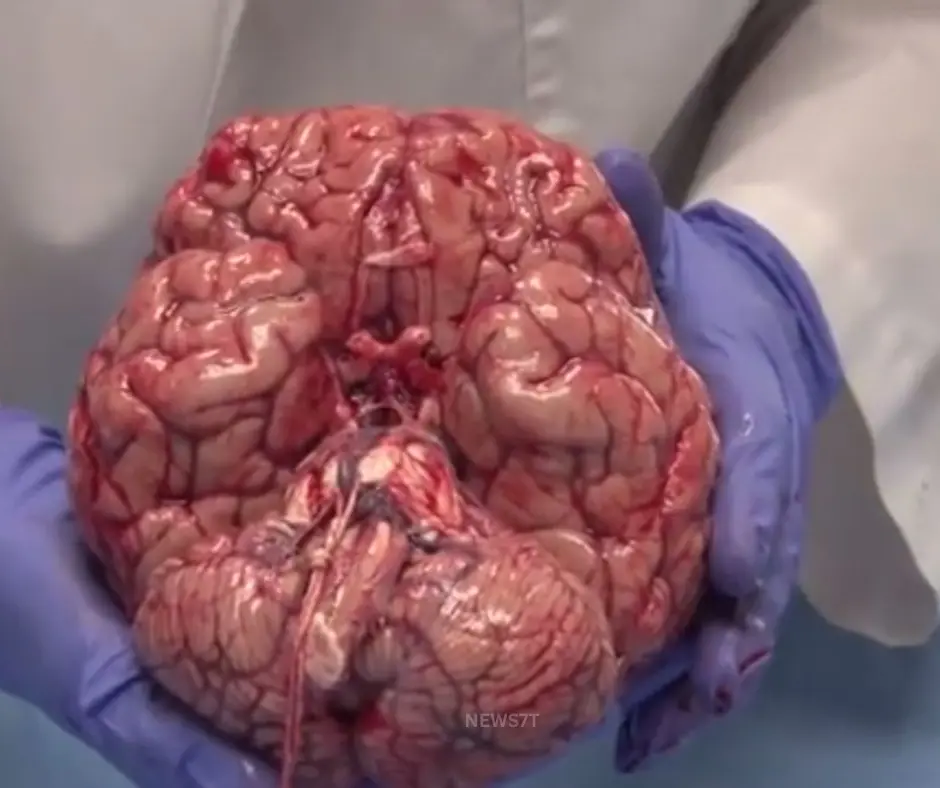 Japanese Scientists Create Breakthrough Human Brain Circuit in Laboratory (photo 4)